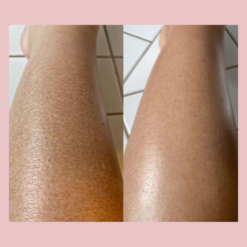 Luva de Esfoliação - Soft Skin