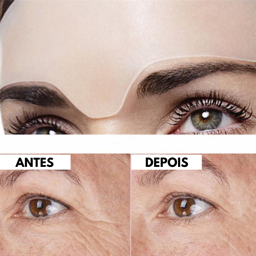 Skin Lifter  - Adesivo Rejuvenescedor - Magazine All In